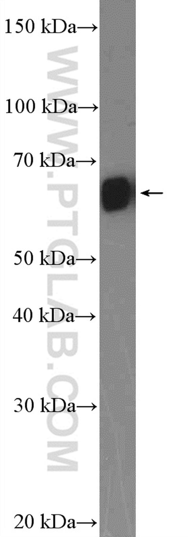 GNRHR Antibody in Western Blot (WB)