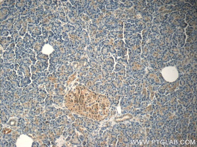 FOXA2 Antibody in Immunohistochemistry (Paraffin) (IHC (P))