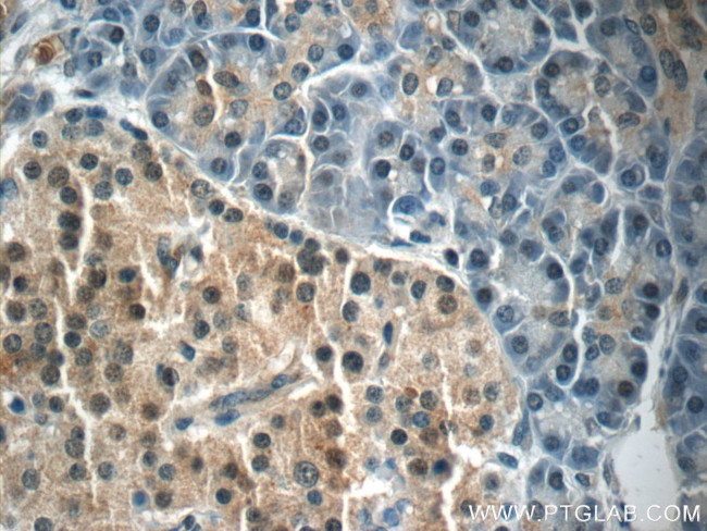 FOXA2 Antibody in Immunohistochemistry (Paraffin) (IHC (P))