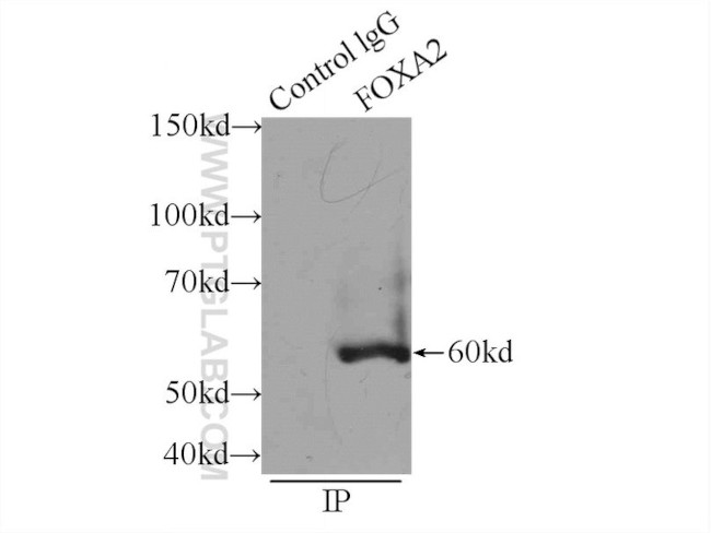 FOXA2 Antibody in Immunoprecipitation (IP)