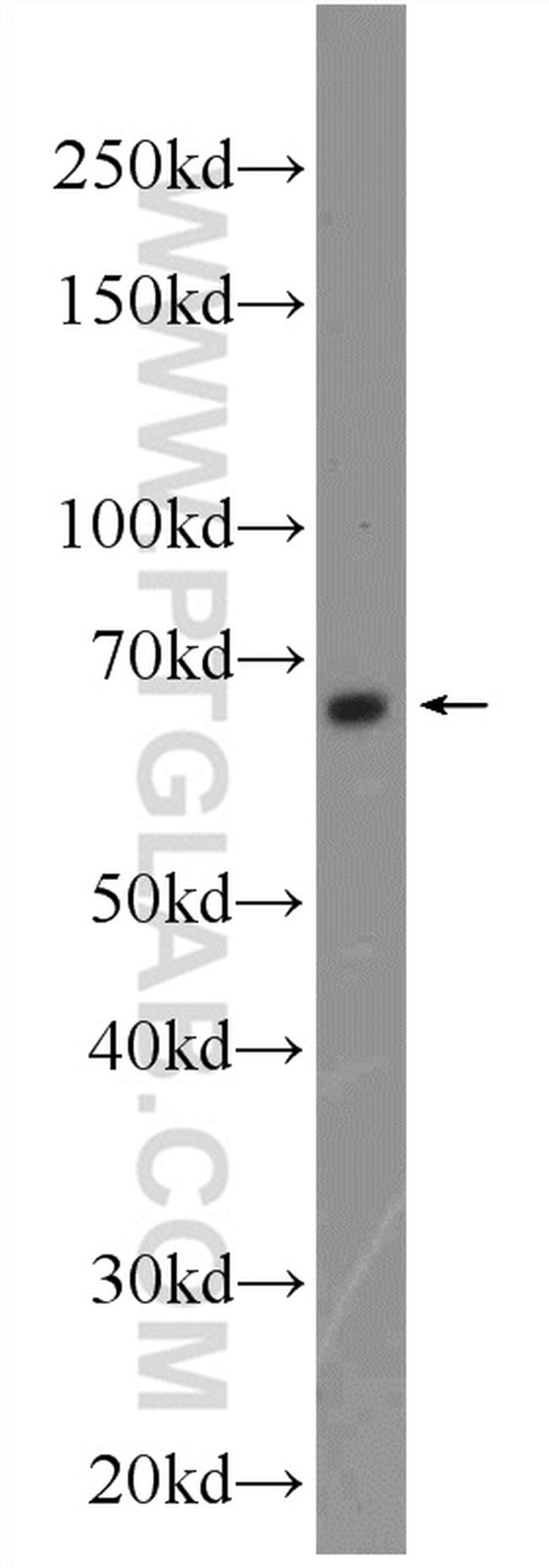 FOXA2 Antibody in Western Blot (WB)