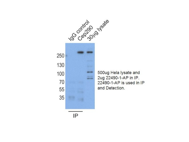CEP290 Antibody in Immunoprecipitation (IP)