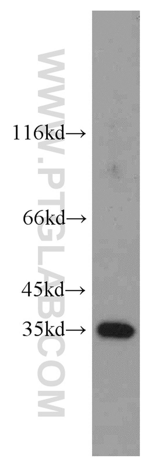 CNOT9 Antibody in Western Blot (WB)