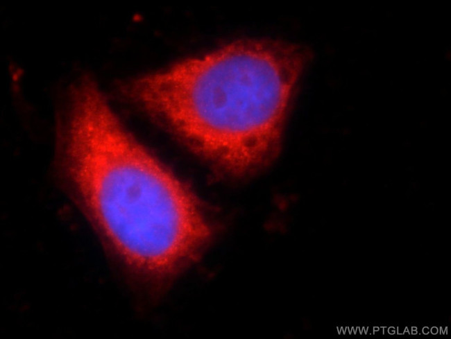 CNOT9 Antibody in Immunocytochemistry (ICC/IF)