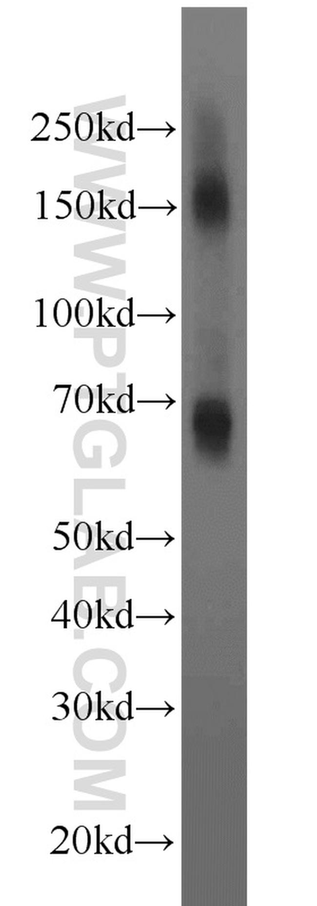 EAAT2 Antibody in Western Blot (WB)