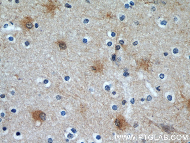 EAAT2 Antibody in Immunohistochemistry (Paraffin) (IHC (P))