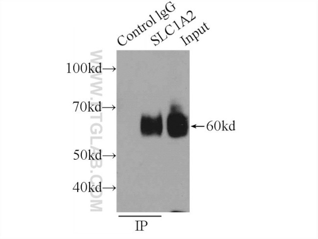 EAAT2 Antibody in Immunoprecipitation (IP)