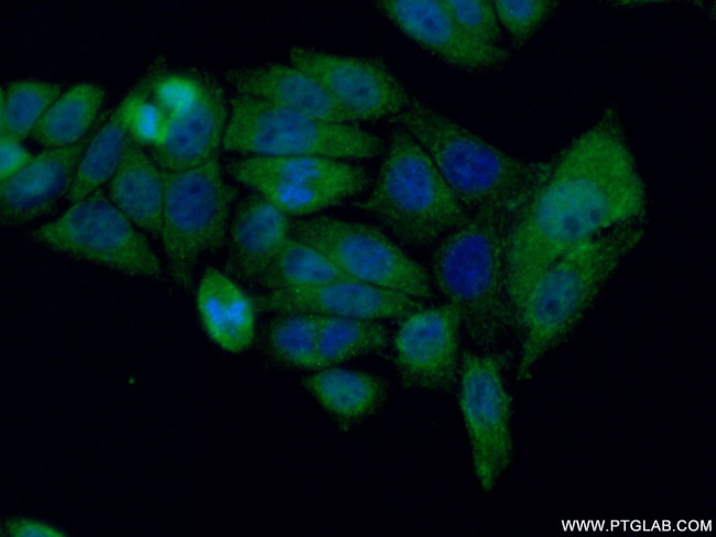 AIRE Antibody in Immunocytochemistry (ICC/IF)