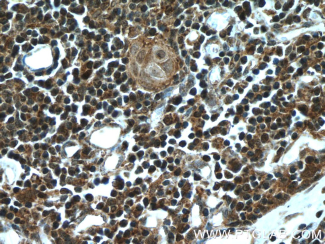 AIRE Antibody in Immunohistochemistry (Paraffin) (IHC (P))