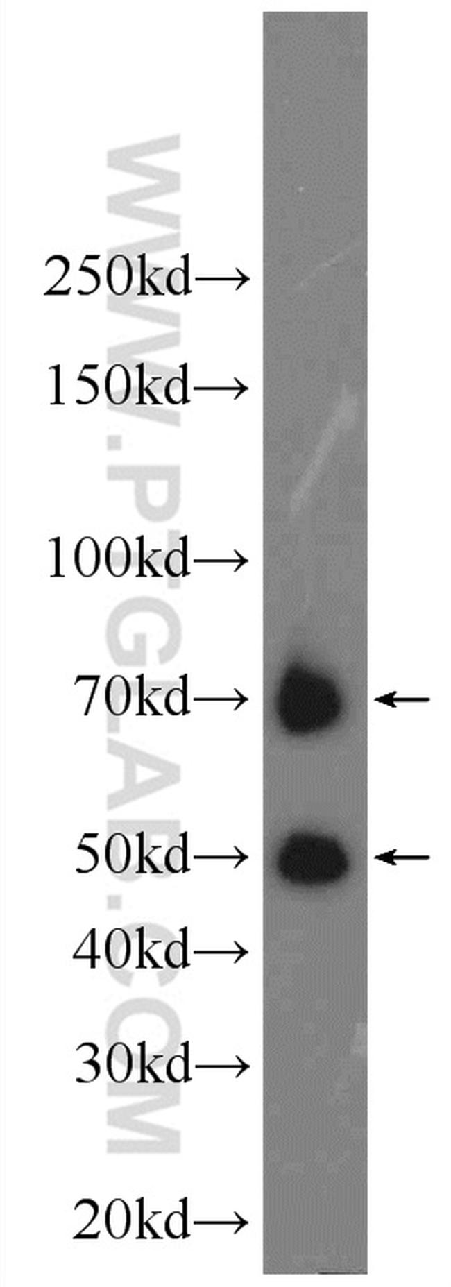 AIRE Antibody in Western Blot (WB)