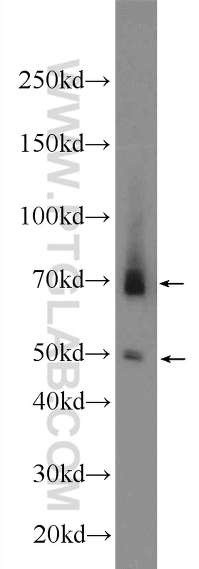 AIRE Antibody in Western Blot (WB)