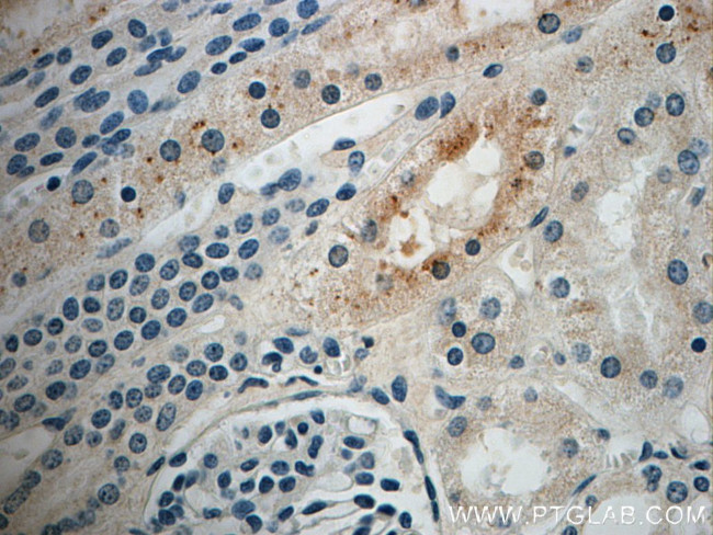 SRGAP2 Antibody in Immunohistochemistry (Paraffin) (IHC (P))