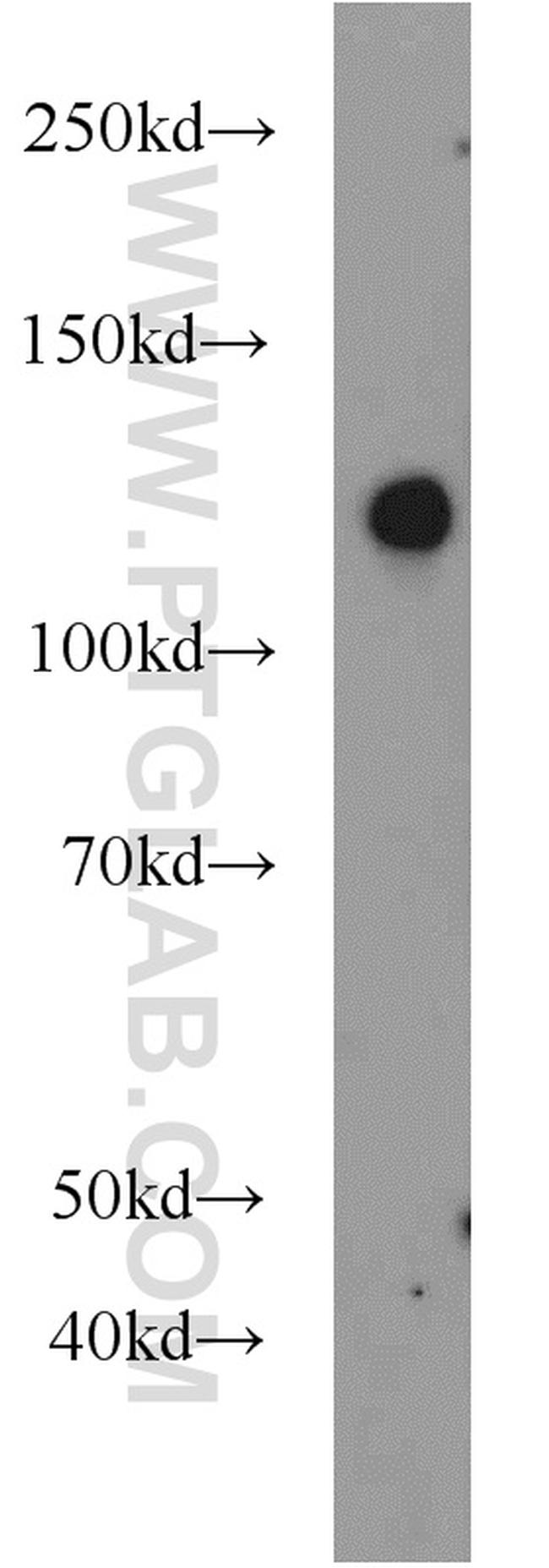 SRGAP2 Antibody in Western Blot (WB)