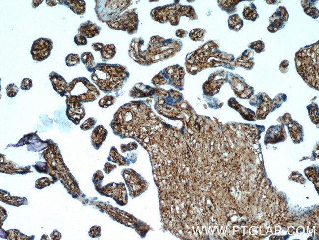 HPGDS Antibody in Immunohistochemistry (Paraffin) (IHC (P))