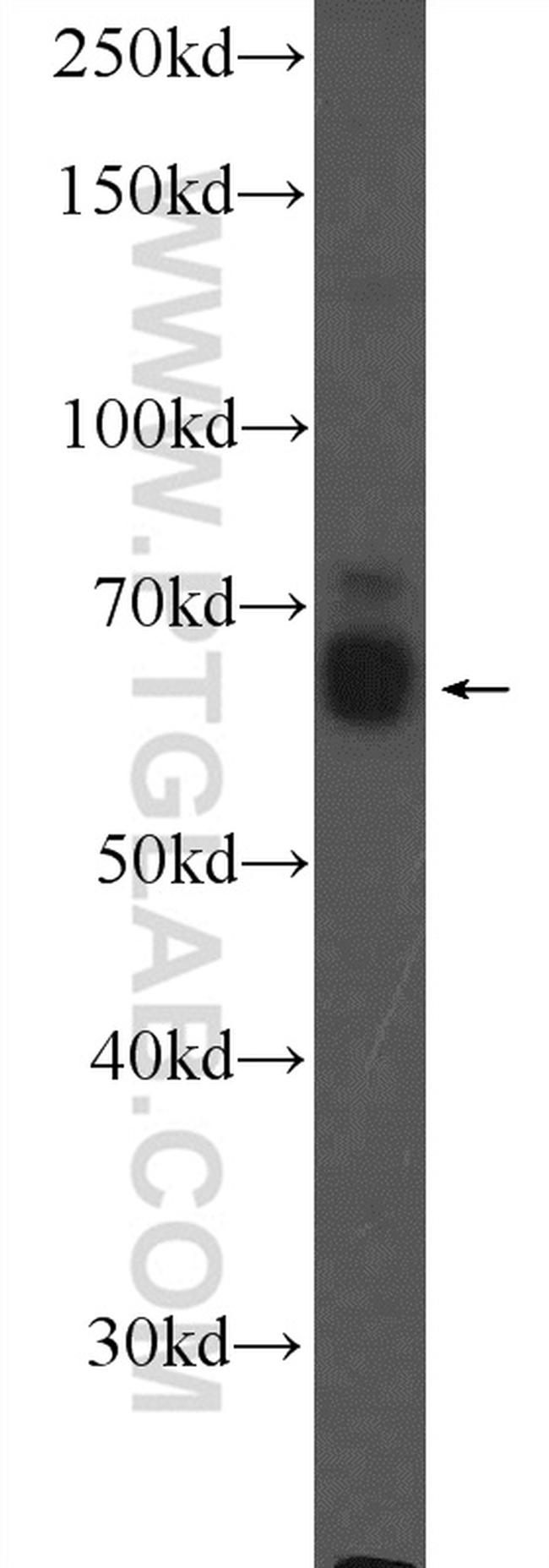 DAT Antibody in Western Blot (WB)