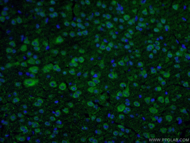 DAT Antibody in Immunohistochemistry (PFA fixed) (IHC (PFA))