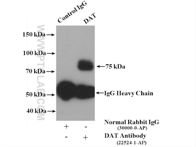 DAT Antibody in Western Blot (WB)