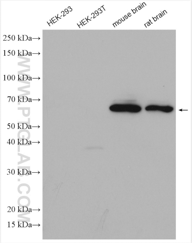 DAT Antibody in Western Blot (WB)