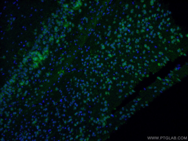 DAT Antibody in Immunohistochemistry (PFA fixed) (IHC (PFA))