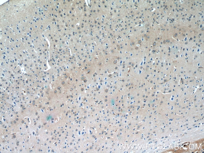 DAT Antibody in Immunohistochemistry (Paraffin) (IHC (P))