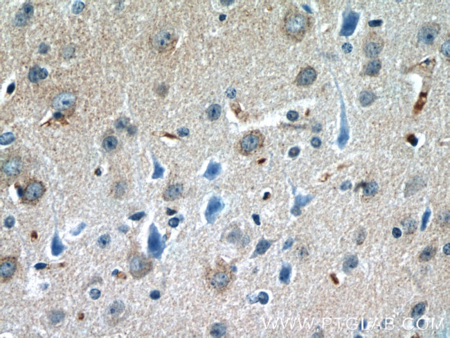 DAT Antibody in Immunohistochemistry (Paraffin) (IHC (P))