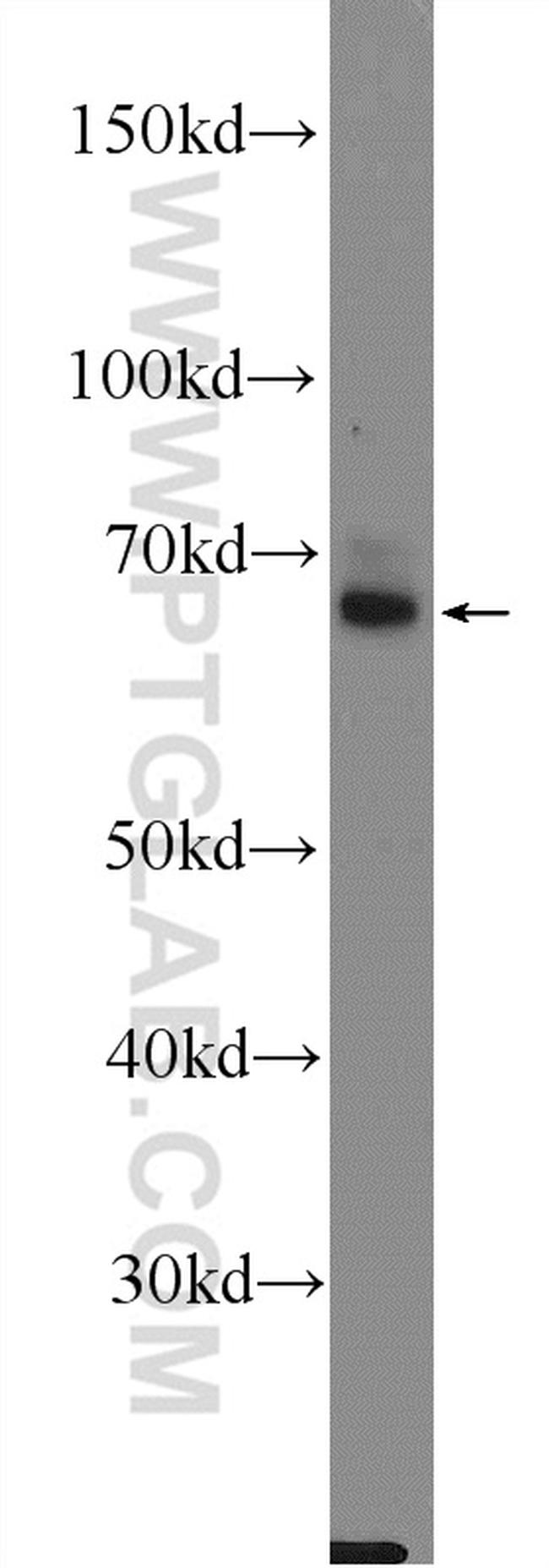 DAT Antibody in Western Blot (WB)