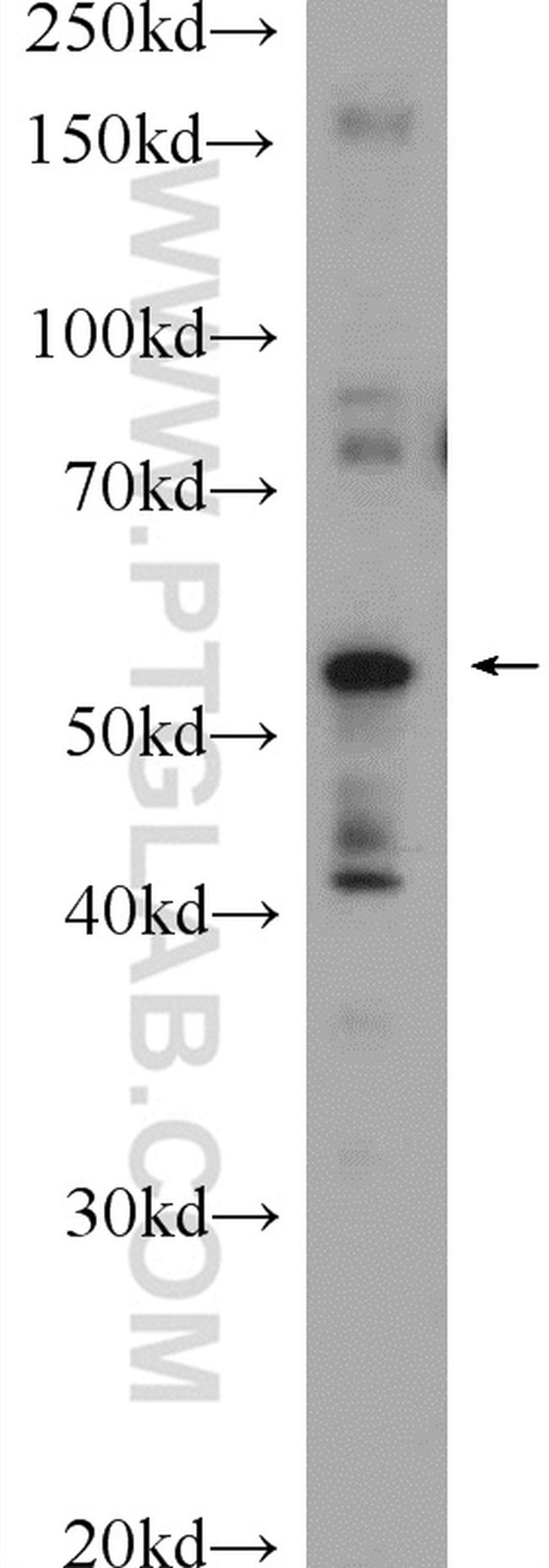 ABHD15 Antibody in Western Blot (WB)