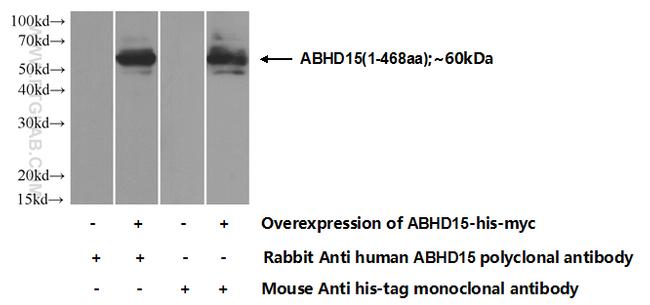 ABHD15 Antibody in Western Blot (WB)