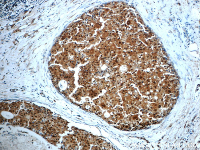 WDR61 Antibody in Immunohistochemistry (Paraffin) (IHC (P))