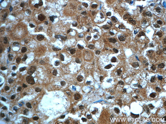 WDR61 Antibody in Immunohistochemistry (Paraffin) (IHC (P))