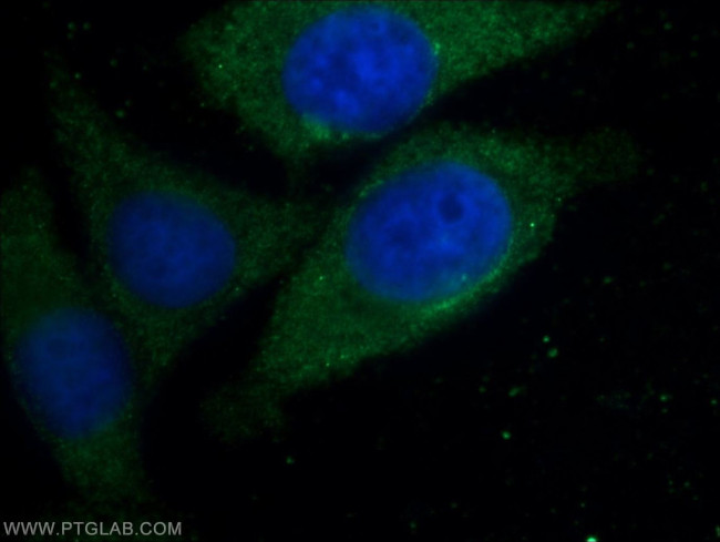 GAB2 Antibody in Immunocytochemistry (ICC/IF)