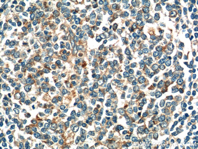 GAB2 Antibody in Immunohistochemistry (Paraffin) (IHC (P))