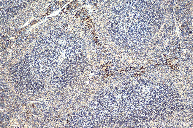 GAB2 Antibody in Immunohistochemistry (Paraffin) (IHC (P))