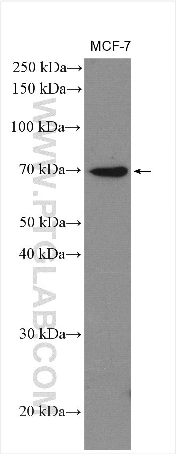 GAB2 Antibody in Western Blot (WB)