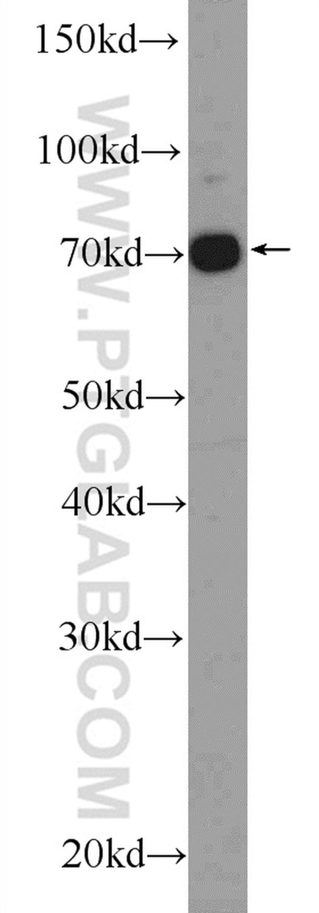 GAB2 Antibody in Western Blot (WB)