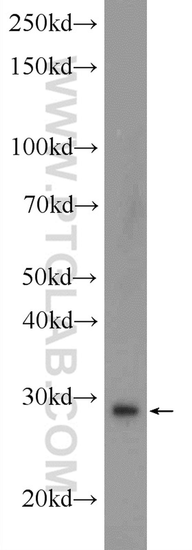 FTSJ2 Antibody in Western Blot (WB)