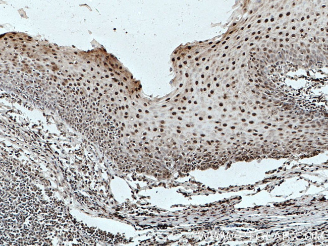 ELF1 Antibody in Immunohistochemistry (Paraffin) (IHC (P))