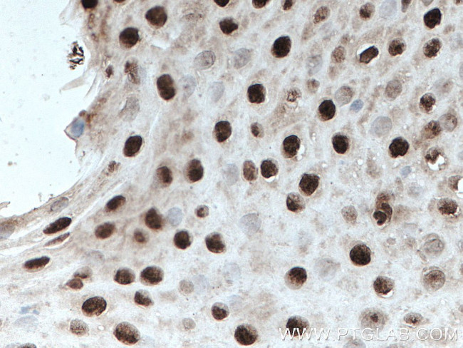 ELF1 Antibody in Immunohistochemistry (Paraffin) (IHC (P))