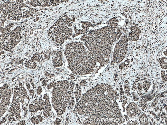 ELF1 Antibody in Immunohistochemistry (Paraffin) (IHC (P))