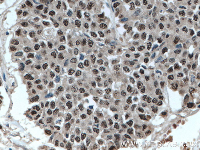 ELF1 Antibody in Immunohistochemistry (Paraffin) (IHC (P))