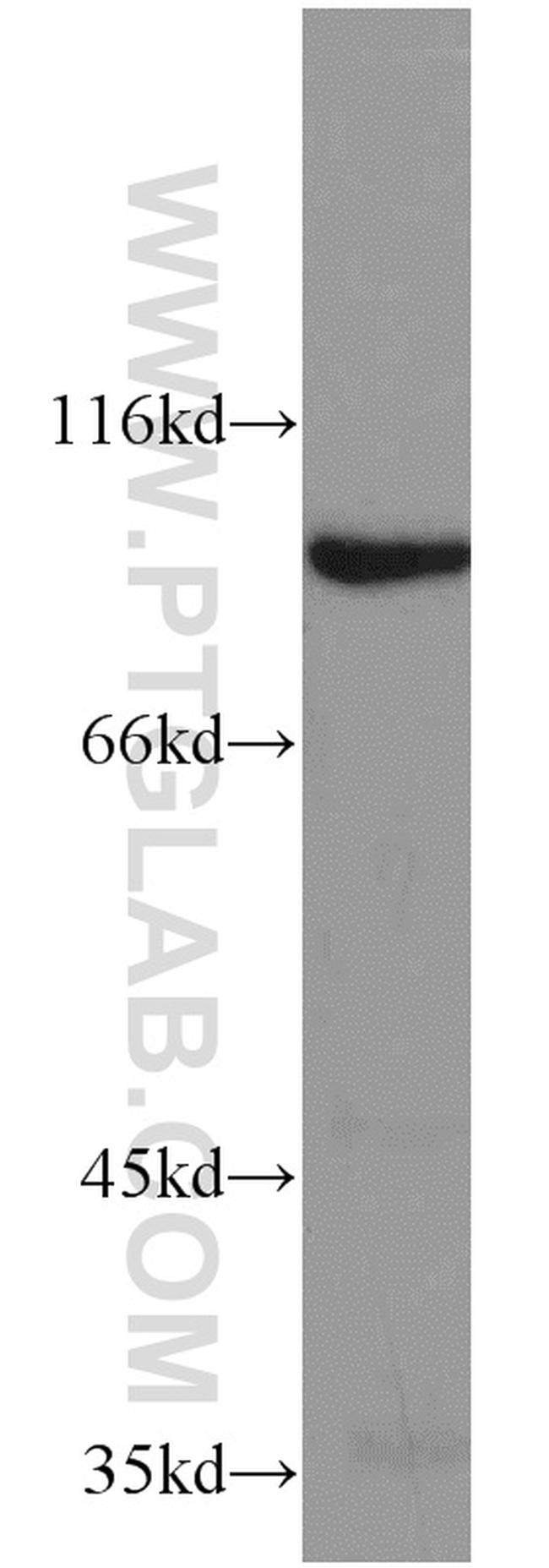 ELF1 Antibody in Western Blot (WB)