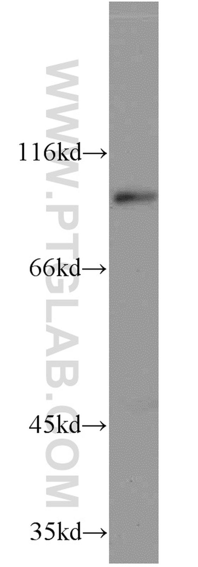 ELF1 Antibody in Western Blot (WB)