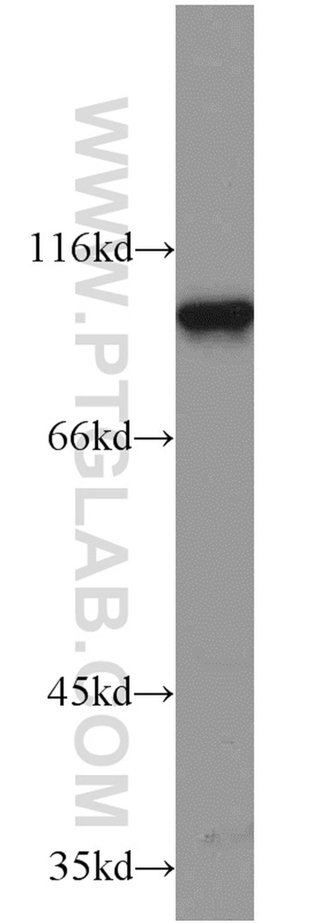 ELF1 Antibody in Western Blot (WB)