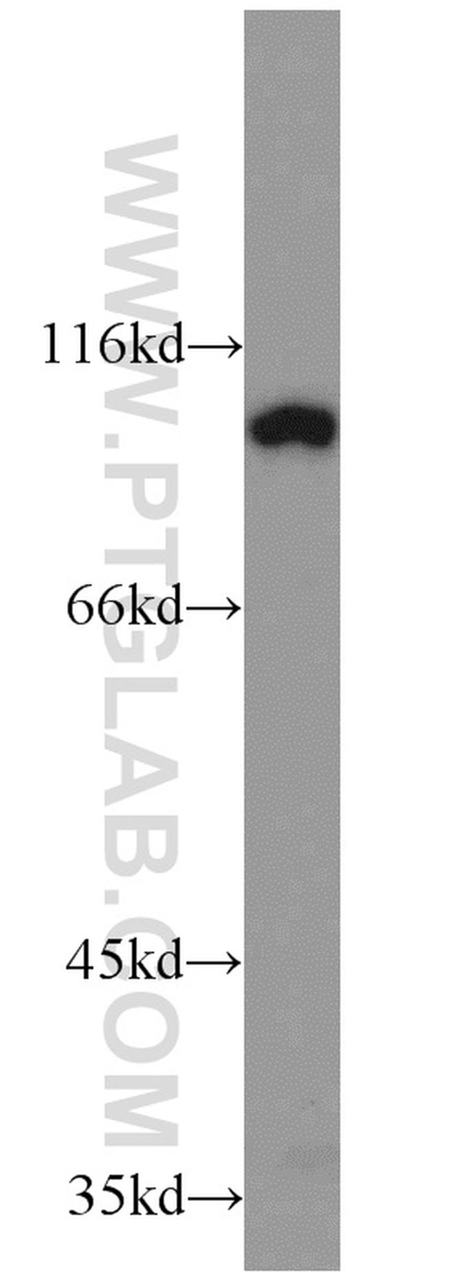 ELF1 Antibody in Western Blot (WB)