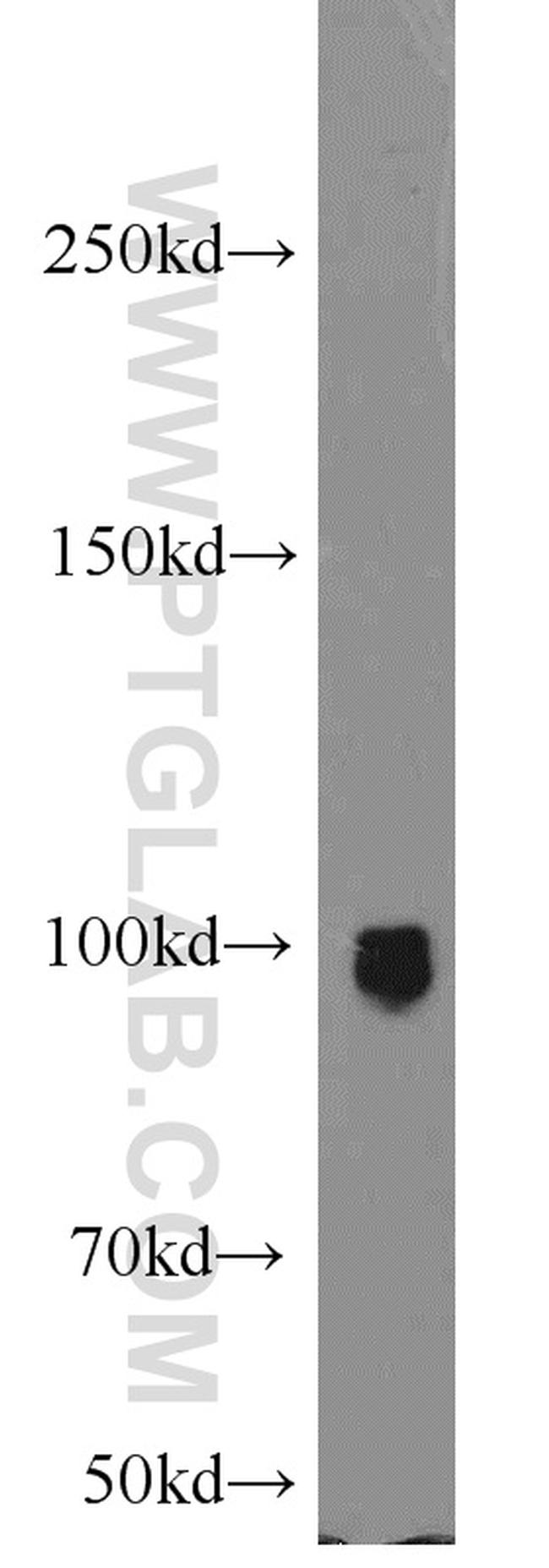 ELF1 Antibody in Western Blot (WB)