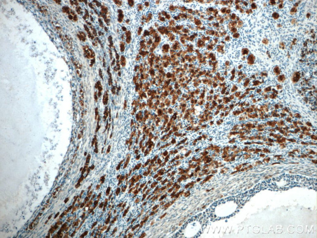 C4orf49 Antibody in Immunohistochemistry (Paraffin) (IHC (P))