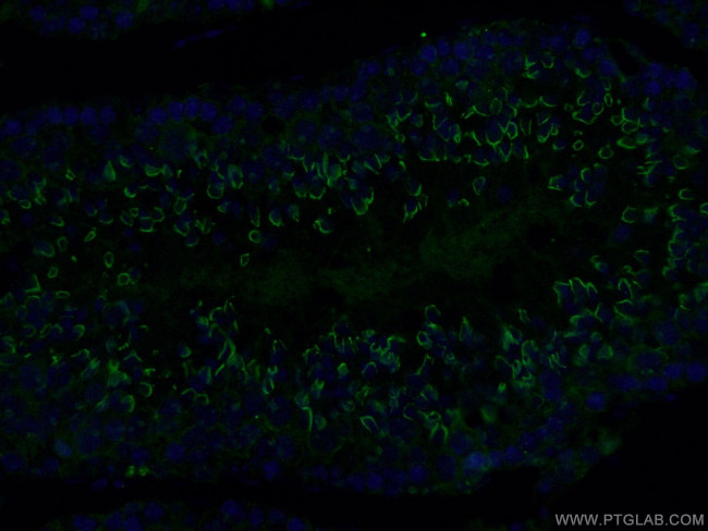 C4orf49 Antibody in Immunohistochemistry (PFA fixed) (IHC (PFA))