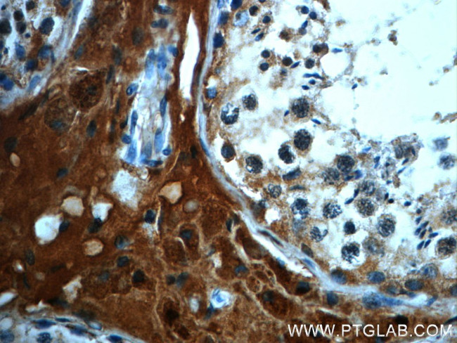 C4orf49 Antibody in Immunohistochemistry (Paraffin) (IHC (P))