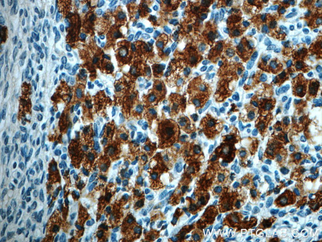 C4orf49 Antibody in Immunohistochemistry (Paraffin) (IHC (P))