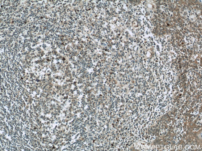 RNASEL Antibody in Immunohistochemistry (Paraffin) (IHC (P))